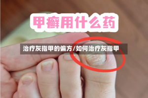 治疗灰指甲的偏方/如何治疗灰指甲
