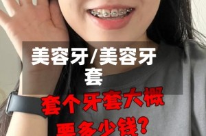 美容牙/美容牙套