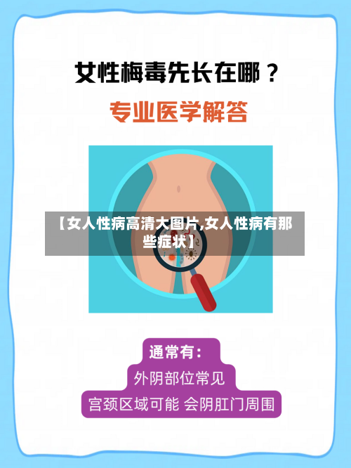 【女人性病高清大图片,女人性病有那些症状】-第1张图片