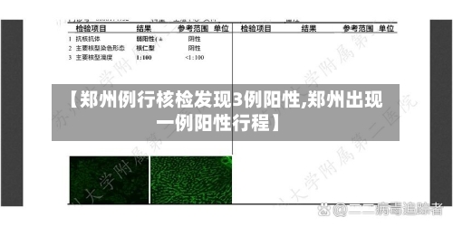 【郑州例行核检发现3例阳性,郑州出现一例阳性行程】-第1张图片