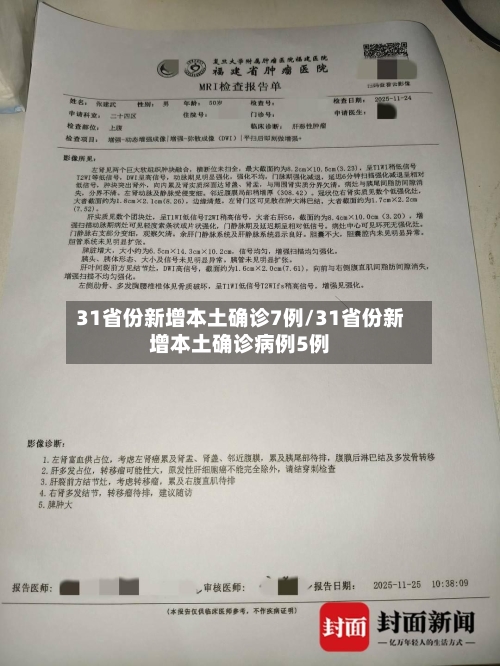31省份新增本土确诊7例/31省份新增本土确诊病例5例-第2张图片