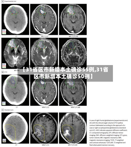 【31省区市新增本土确诊55例,31省区市新增本土确诊50例】-第2张图片